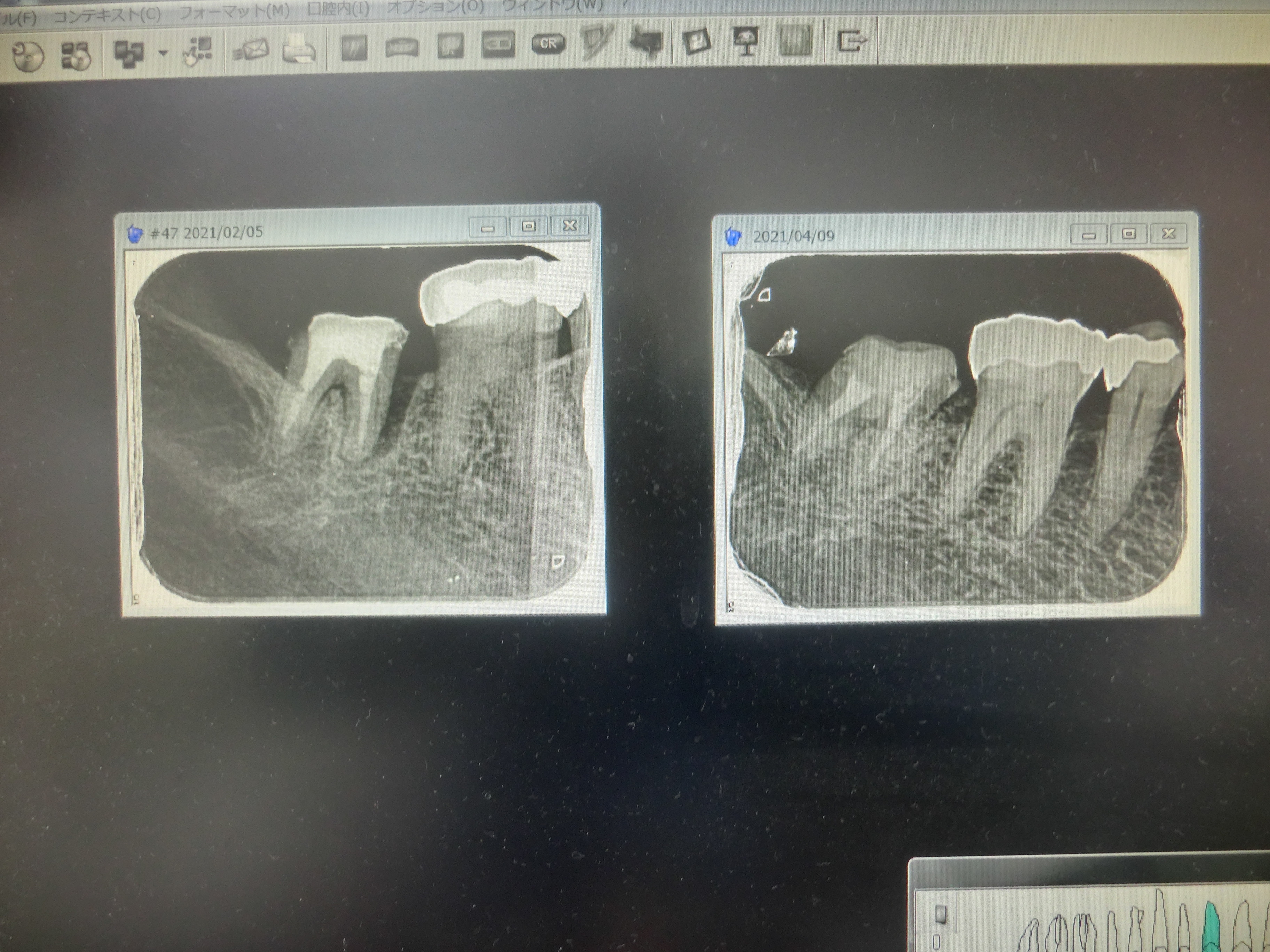 CIMG9233 - むらたまこと